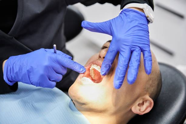 Best Emergency Tooth Extraction in Lake Oswego, OR